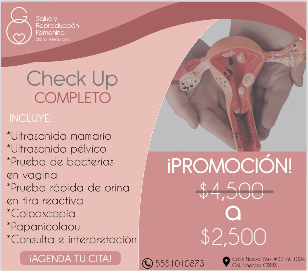 Promoción 1